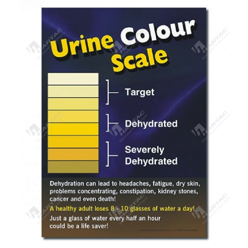 HS11390 Urine Colour Scale Laminated Safety Poster 300mm x 420mm